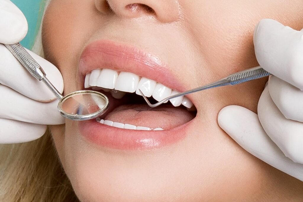 Should You Consider smile Getting Dental Veneers?