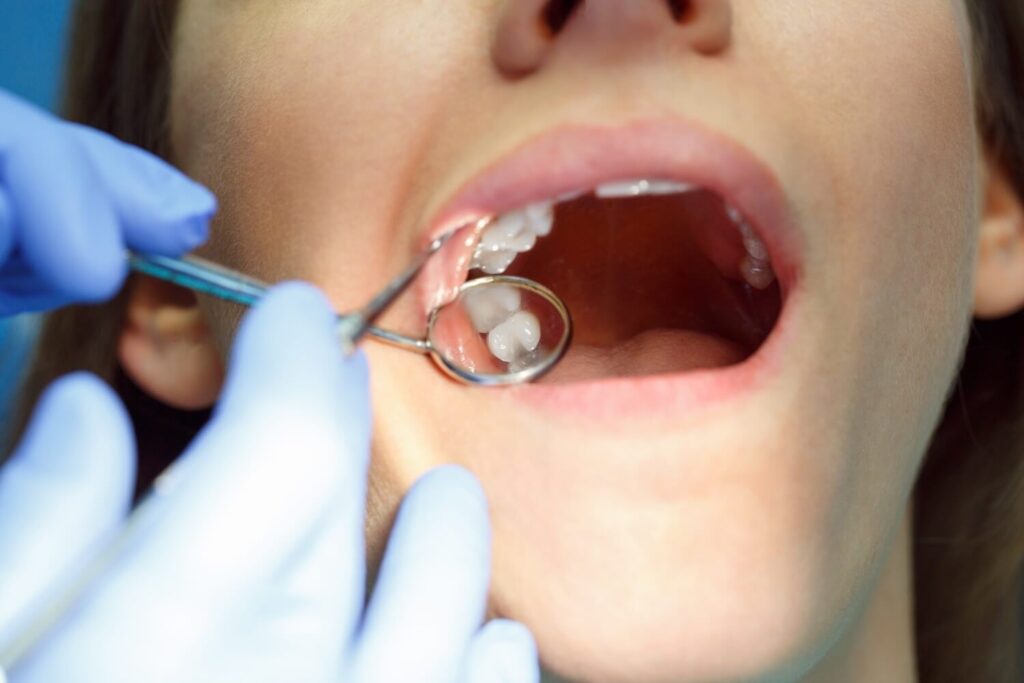 How Does a Dentist Treat Gum Disease? periodontal